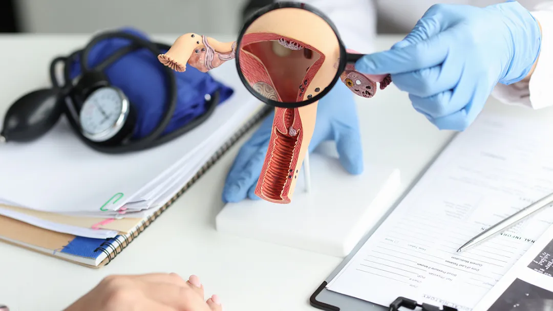 Gynecological consultation and examination setup showing uterus model