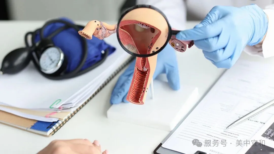 Gynecologist examining uterine anatomy model during consultation