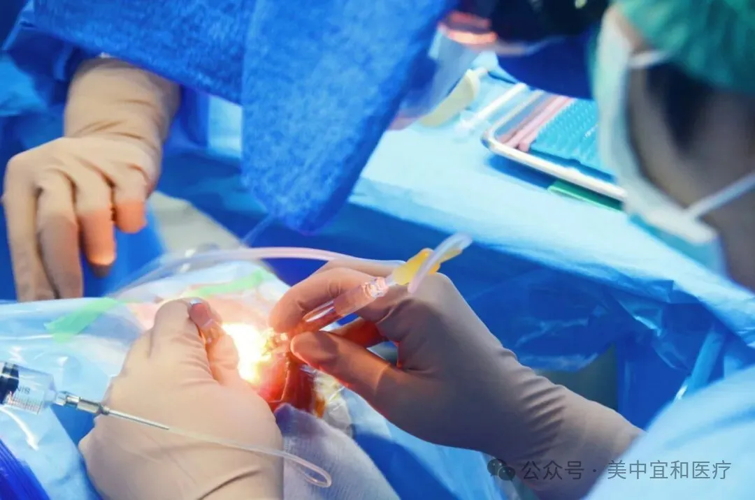 ICL implantation procedure at AMCARE Beijing